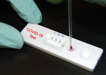 कोभिड-१९ पत्ता लगाउन प्रयोग गरिँदै आएको आरडिटी प्रयोग गर्न नमिल्ने – सरकारी अनुसन्धान परिषद्